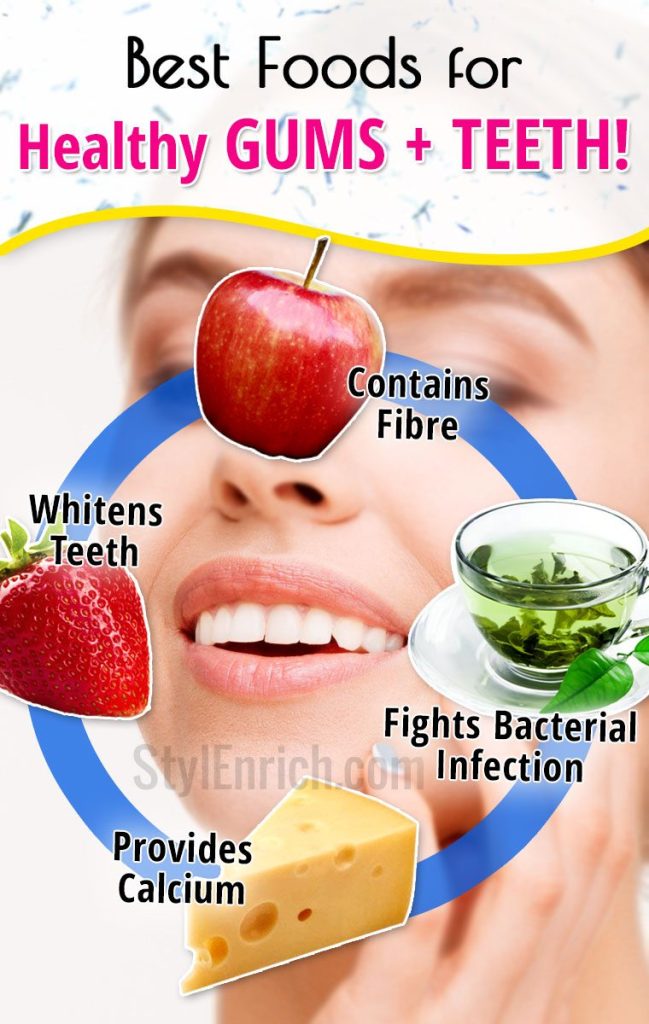 Content image for The Impact of Nutrition on Gum Health: Foods for Strong Gums and Healthy Teeth