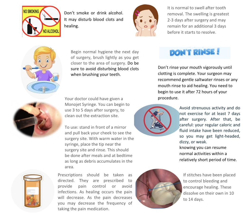 Content image for Decoding the Mysteries of Wisdom Teeth: Extraction and Post-Operative Care
