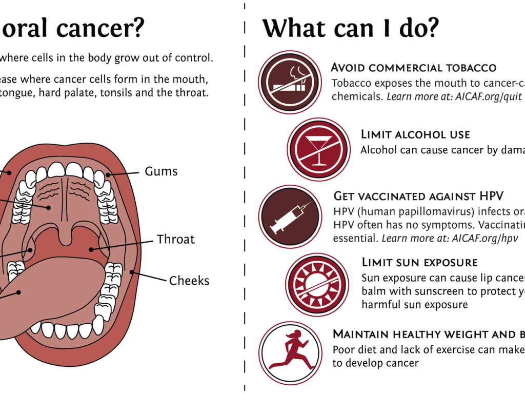 Content image for Decoding the Complexities of Oral Cancer: Early Detection and Prevention