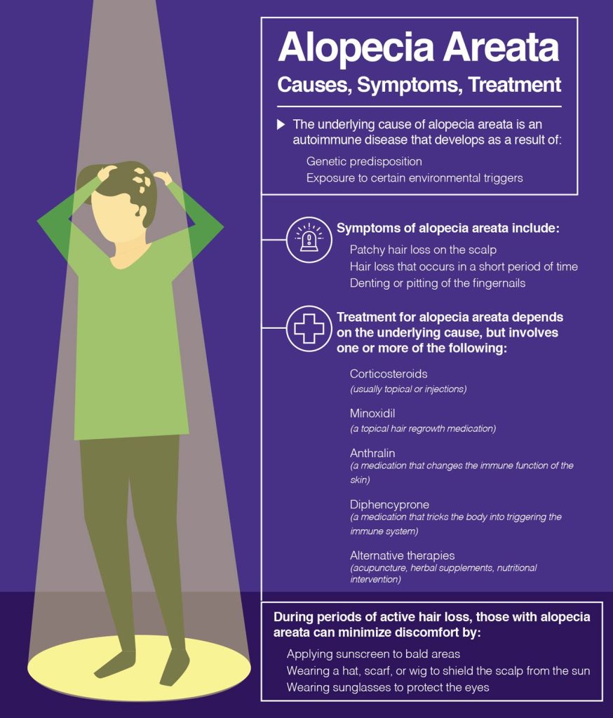 Content image for Demystifying Alopecia Areata: Exploring Autoimmune Causes and Therapies