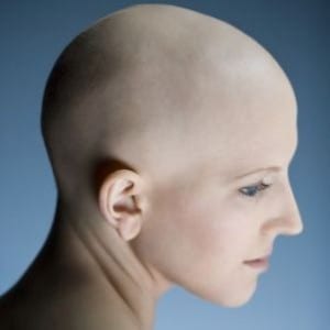 Content image for Preventing Hair Loss from Medical Treatments: Chemotherapy and Radiation