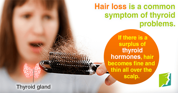 Content image for Understanding and Managing Hair Loss from Thyroid Disorders: Symptoms and Relief
