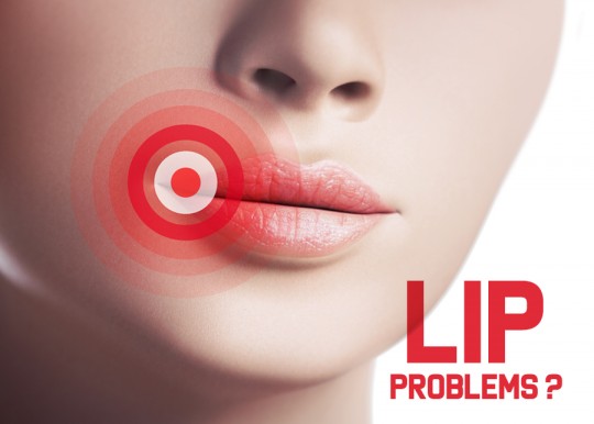 Featured image for Understanding and Treating Common Lip Problems: Causes and Relief