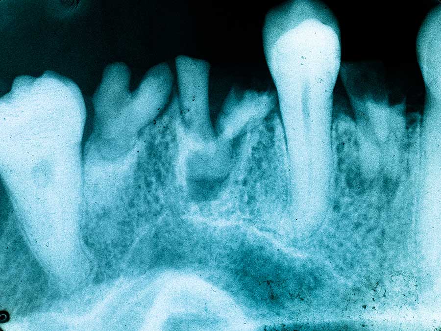 Content image for Decoding the Mysteries of Oral Pathology: Understanding and Treating Oral Diseases