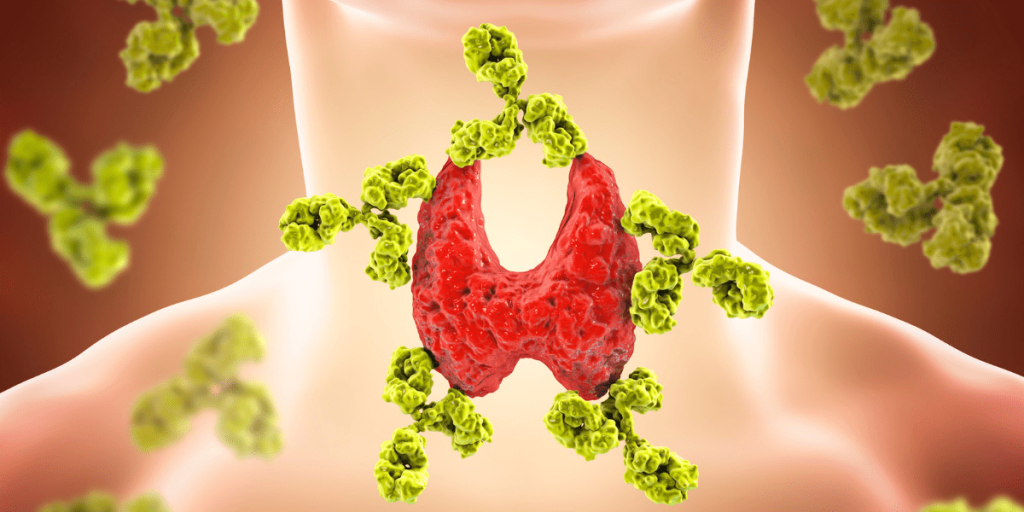 Content image for Demystifying Autoimmune Diseases: Exploring Causes, Symptoms, and Treatments