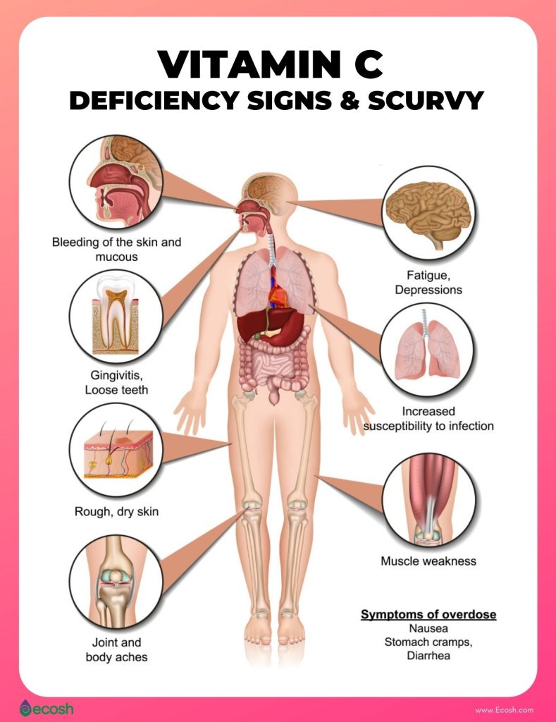 Content image for Preventing Vitamin C Deficiency: Immune Support, Skin Health, and Benefits