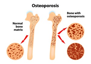 Featured image for The Crucial Role of Collagen Supplements: Skin, Joint, and Bone Health Benefits