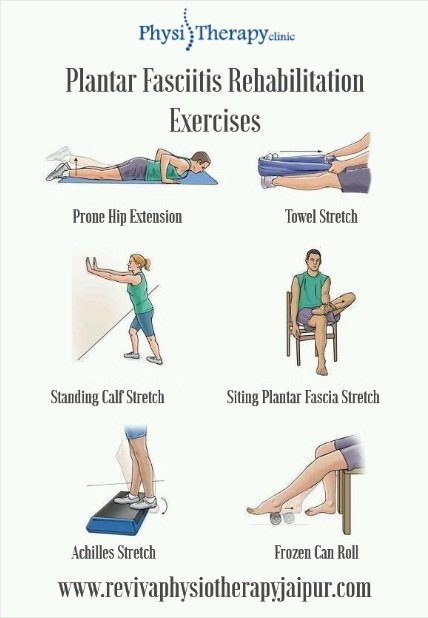 Featured image for Preventing and Managing Plantar Fasciitis: Physiotherapy Exercises and Stretches