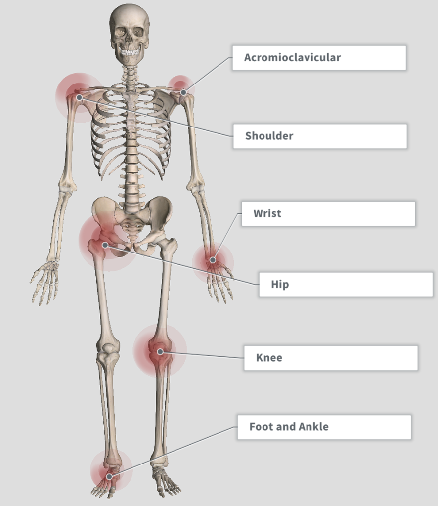 Content image for The Impact of Environmental Factors on Joint Pain: Physiotherapy Solutions