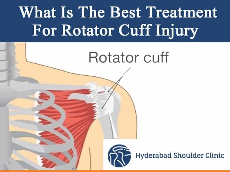 Featured image for Decoding the Complexities of Rotator Cuff Injuries: Physiotherapy Options