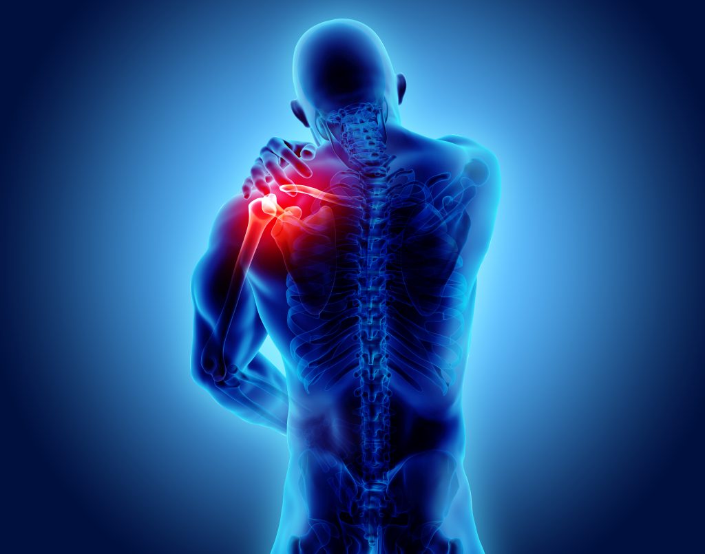 Content image for Decoding the Complexities of Rotator Cuff Injuries: Physiotherapy Options