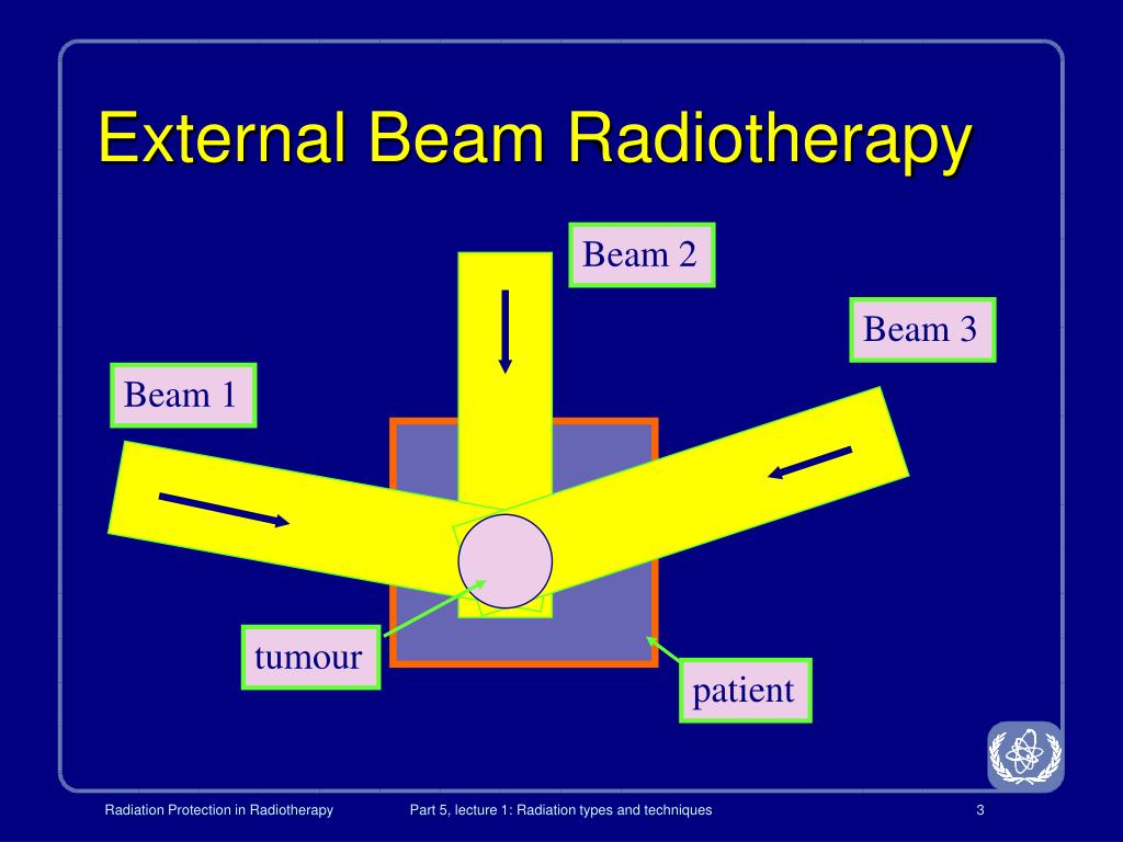 Featured image for Navigating the Challenges of Radiation Therapy: Techniques and Benefits