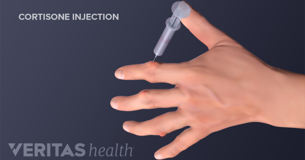 Content image for The Impact of Aging on Joint Health: Osteoarthritis Treatments and Therapies
