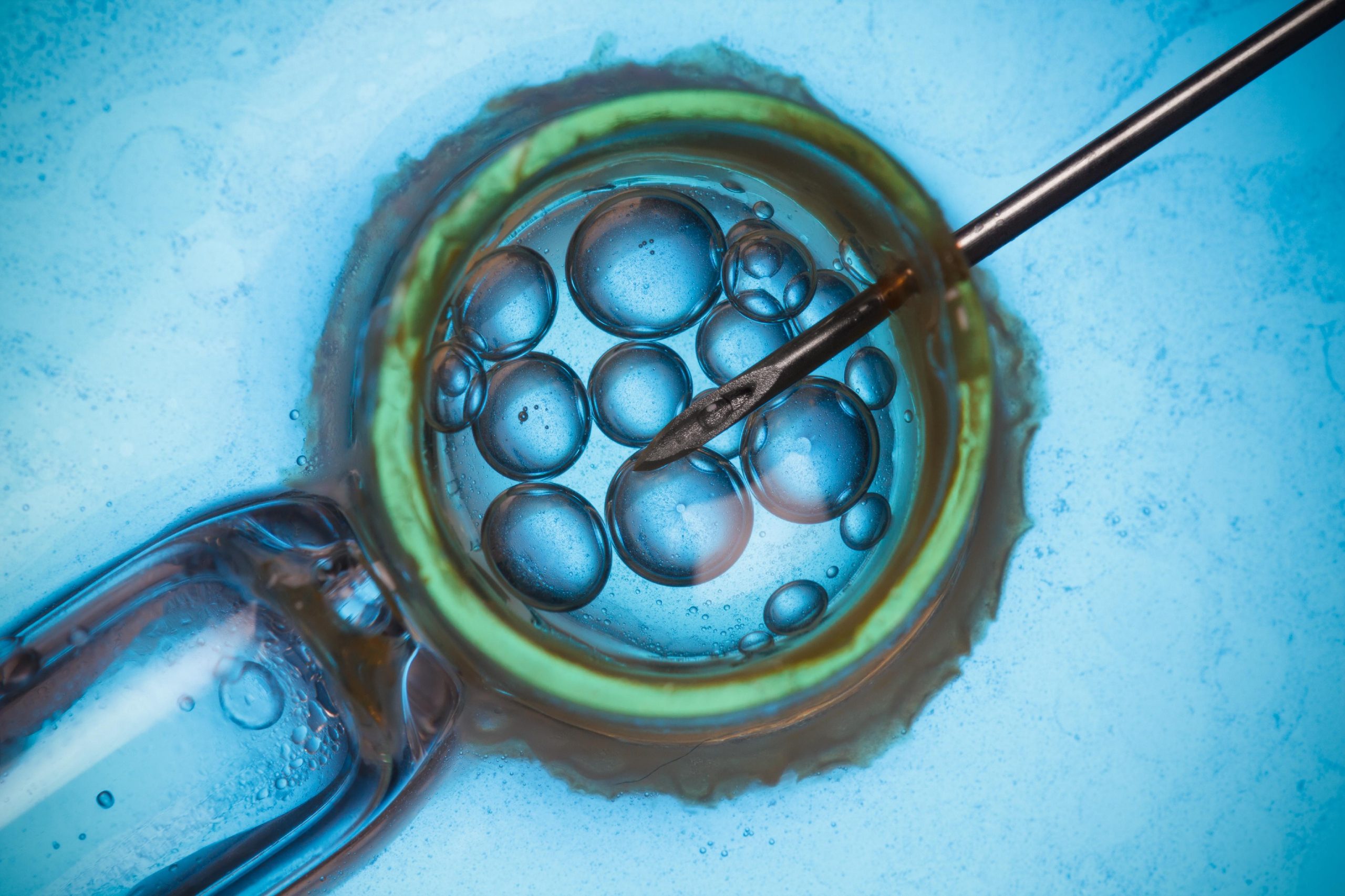 Featured image for Boosting Fertility with In Vitro Fertilization (IVF) and Assisted Reproductive Technology