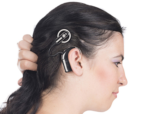 Content image for The Importance of Hearing Treatments: Cochlear Implants and Hearing Aids