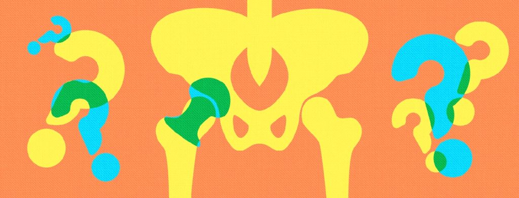 Content image for Understanding and Managing Arthritis with Joint Replacement Surgery