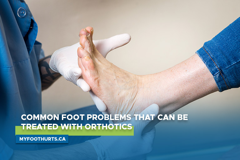 Content image for Understanding and Treating Common Foot Problems with Orthotics and Surgery