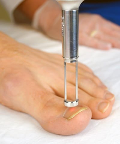 Featured image for Understanding and Treating Common Nail Problems with Laser Treatments